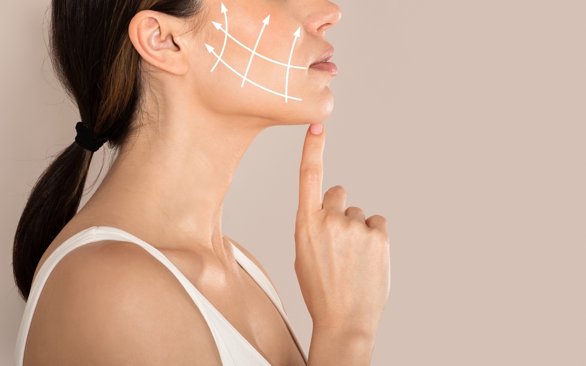 Woman with lifting arrows on her jawline showing the effect of skin tightening in Strongsville, OH